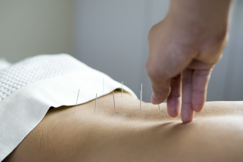 acupuncture pain management Rochester NY clinic